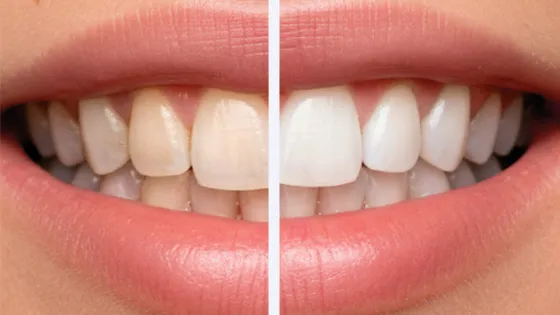 Ilumine Seu Sorriso e Renove Sua Confiança.