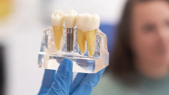 Entenda o problema: gengivite e periodontite