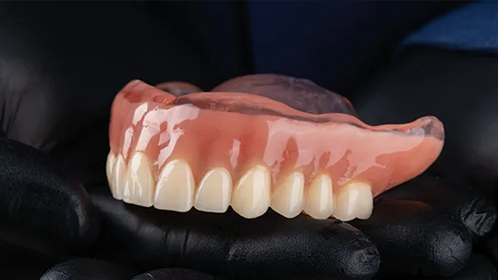 Prótese Removível: resgate seu sorriso e conforto